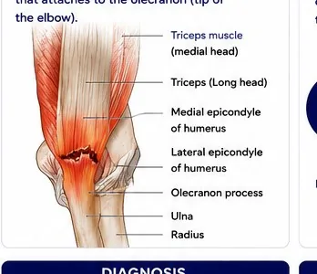 Upper Extremity anatomy