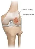 Knee anatomy