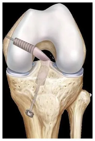 Knee anatomy