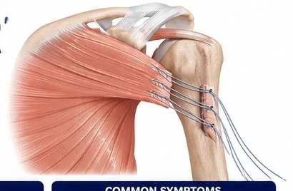 Upper Extremity anatomy