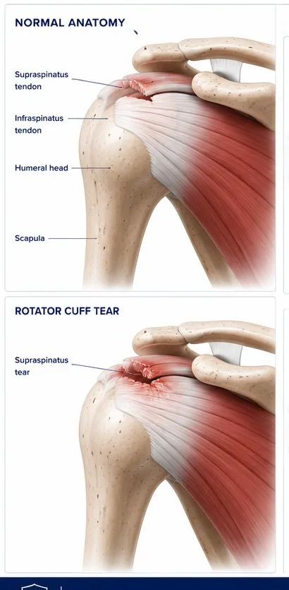 Shoulder anatomy