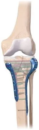 Knee anatomy