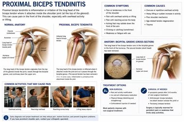 Biceps Tendinitis infographic — Robert Pettit, MD