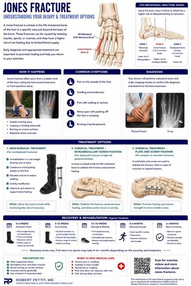 Jones Fracture infographic — Robert Pettit, MD