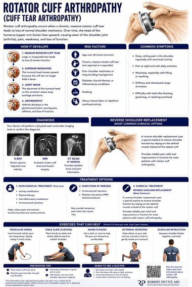 Rotator Cuff Arthropathy infographic — Robert Pettit, MD