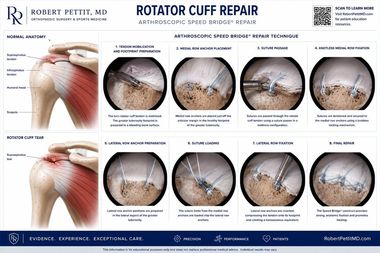 Rotator Cuff Tear infographic — Robert Pettit, MD