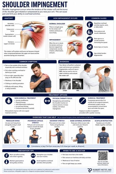 Shoulder Impingement & Bursitis infographic — Robert Pettit, MD