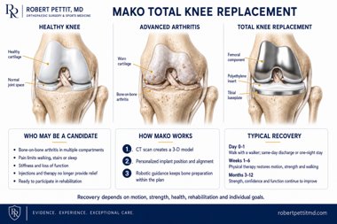 Mako Total Knee Replacement infographic — Robert Pettit, MD